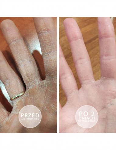 Crema intensa nutritiva alla fragola S.O.S. per mani e piedi 15ml