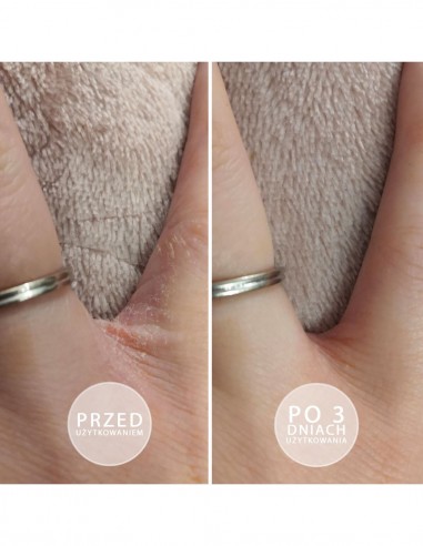 Crema intensa nutritiva alla fragola S.O.S. per mani e piedi 15ml