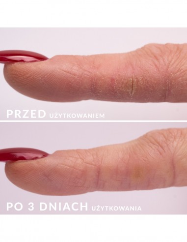 Siero rigenerante per unghie S.O.S. 10ml