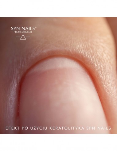 Cheratolitico per rimozione cuticole 30ml