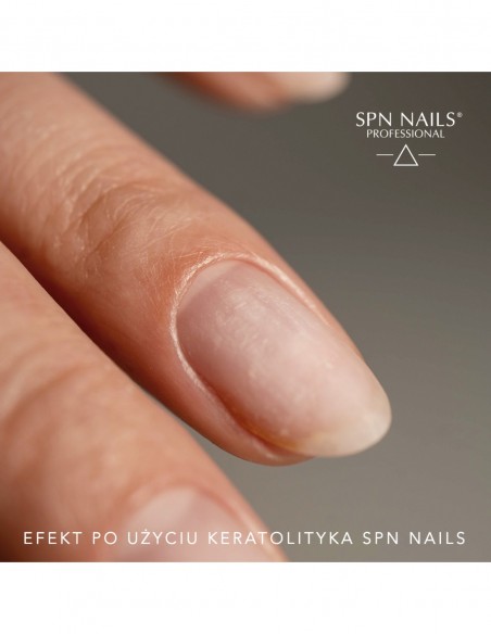 Cheratolitico per rimozione cuticole 30ml Cheratolitico per rimozione cuticole 30ml